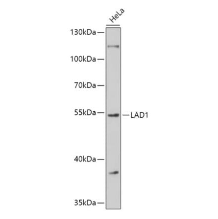Western Blot - Anti-LAD1 Antibody (A308983) - Antibodies.com
