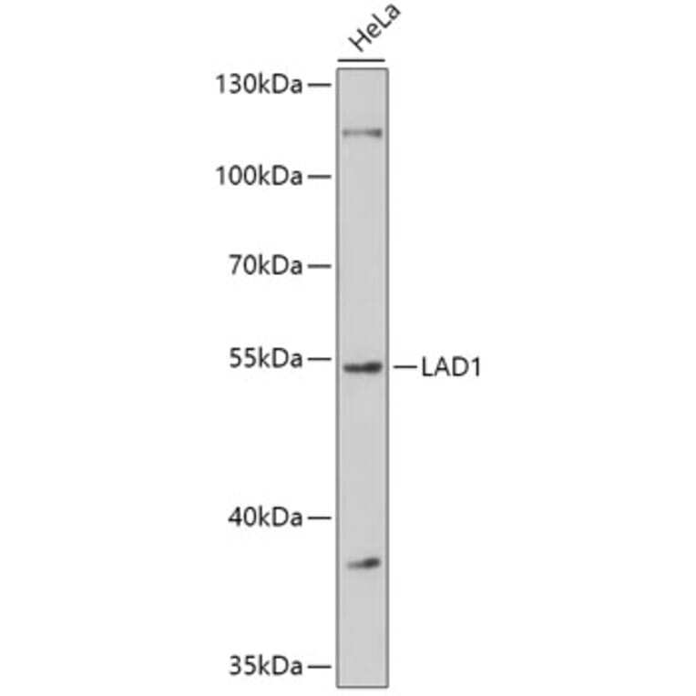 Western Blot - Anti-LAD1 Antibody (A308983) - Antibodies.com