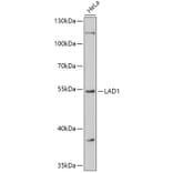 Western Blot - Anti-LAD1 Antibody (A308983) - Antibodies.com