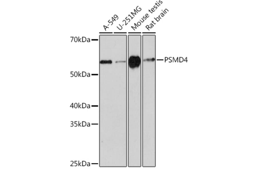 Western Blot - Anti-Proteasome 19S S5A/ASF Antibody [ARC0818] (A308984) - Antibodies.com