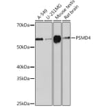 Western Blot - Anti-Proteasome 19S S5A/ASF Antibody [ARC0818] (A308984) - Antibodies.com
