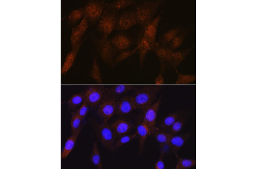 Immunofluorescence - Anti-Proteasome 19S S5A/ASF Antibody [ARC0818] (A308984) - Antibodies.com