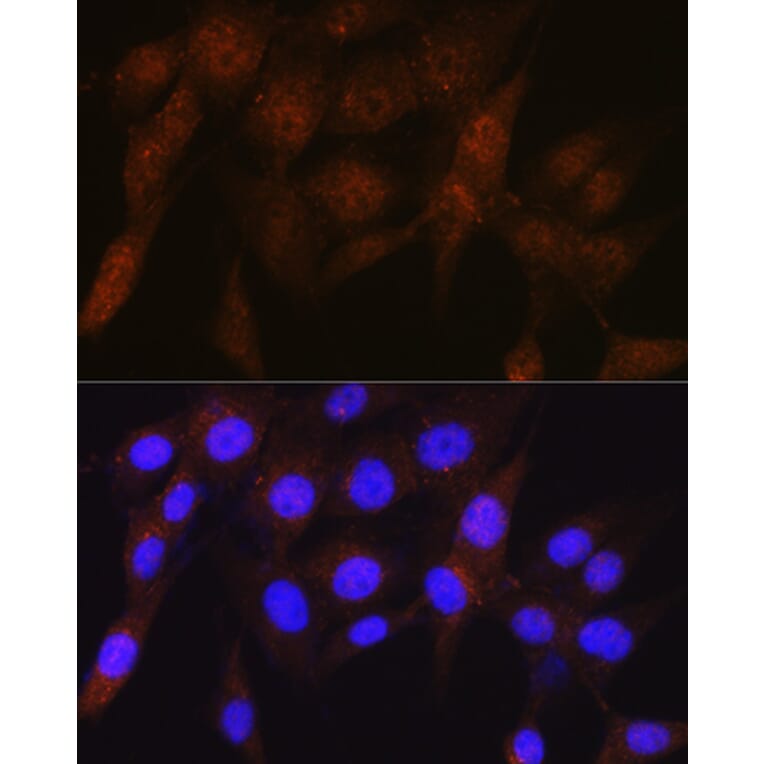 Immunofluorescence - Anti-Proteasome 19S S5A/ASF Antibody [ARC0818] (A308984) - Antibodies.com