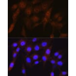 Immunofluorescence - Anti-Proteasome 19S S5A/ASF Antibody [ARC0818] (A308984) - Antibodies.com