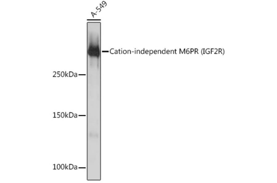 Western Blot - Anti-M6PR (cation independent) Antibody [ARC0263] (A308985) - Antibodies.com