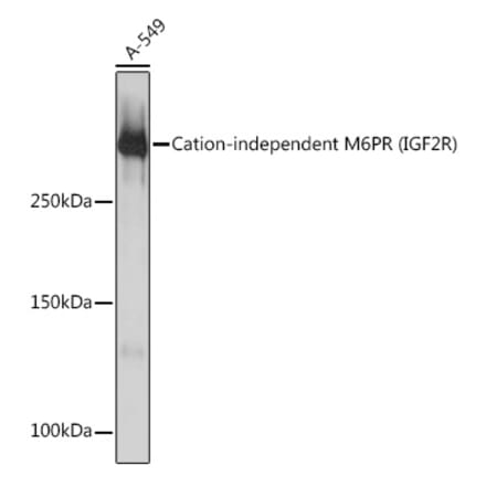 Western Blot - Anti-M6PR (cation independent) Antibody [ARC0263] (A308985) - Antibodies.com