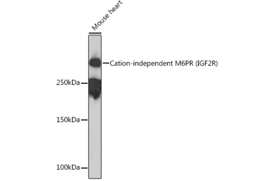 Western Blot - Anti-M6PR (cation independent) Antibody [ARC0263] (A308985) - Antibodies.com