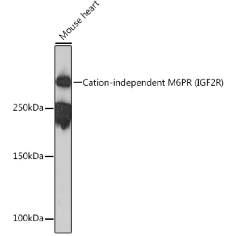 Western Blot - Anti-M6PR (cation independent) Antibody [ARC0263] (A308985) - Antibodies.com