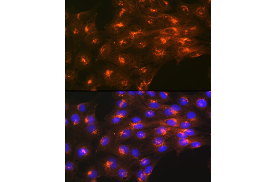 Immunofluorescence - Anti-M6PR (cation independent) Antibody [ARC0263] (A308985) - Antibodies.com