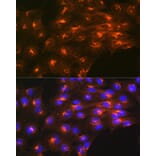 Immunofluorescence - Anti-M6PR (cation independent) Antibody [ARC0263] (A308985) - Antibodies.com