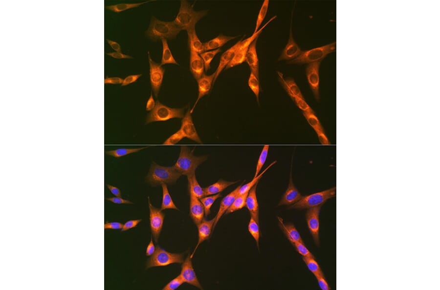 Immunofluorescence - Anti-M6PR (cation independent) Antibody [ARC0263] (A308985) - Antibodies.com