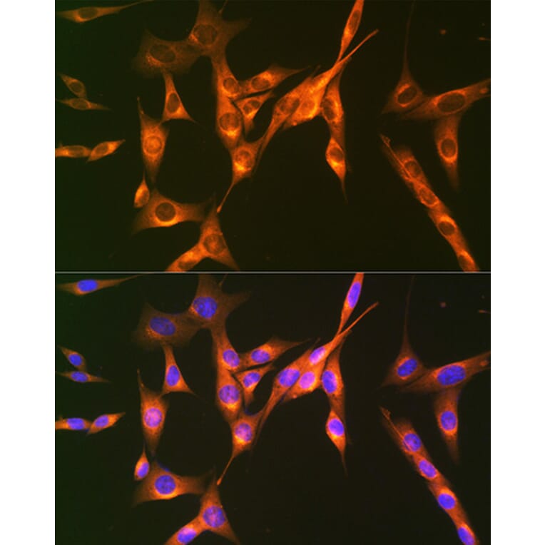 Immunofluorescence - Anti-M6PR (cation independent) Antibody [ARC0263] (A308985) - Antibodies.com