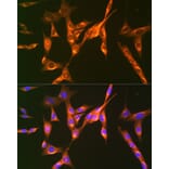 Immunofluorescence - Anti-M6PR (cation independent) Antibody [ARC0263] (A308985) - Antibodies.com