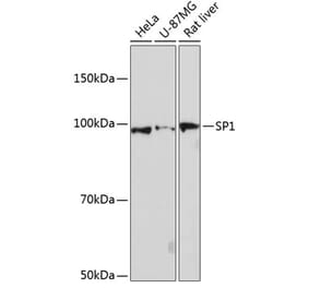 Western Blot - Anti-SP1 Antibody [ARC0128] (A308986) - Antibodies.com