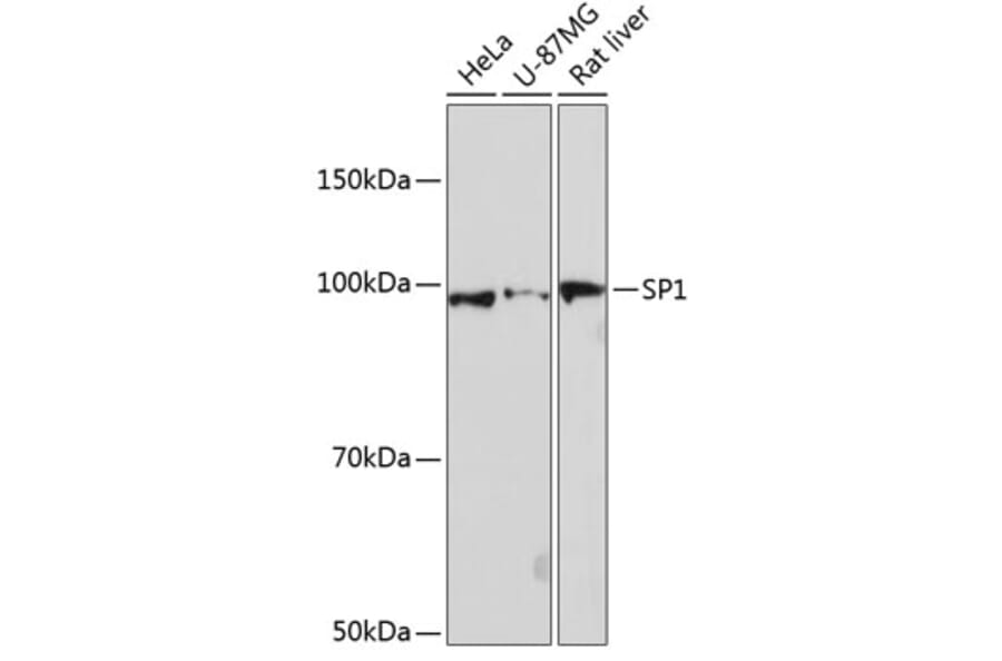 Western Blot - Anti-SP1 Antibody [ARC0128] (A308986) - Antibodies.com