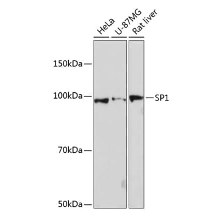 Western Blot - Anti-SP1 Antibody [ARC0128] (A308986) - Antibodies.com