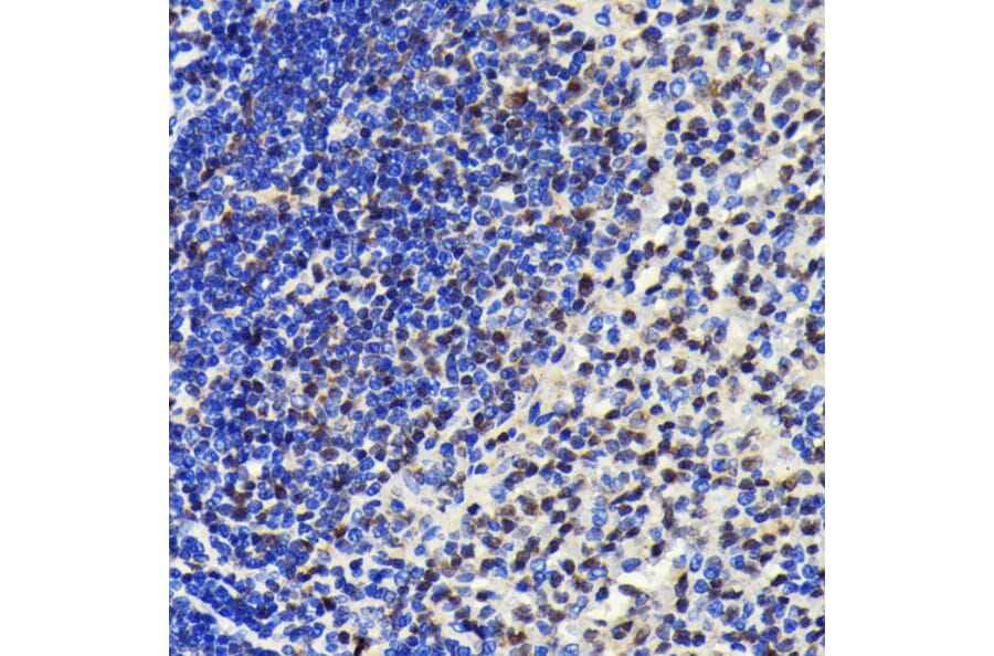 Immunohistochemistry - Anti-SP1 Antibody [ARC0128] (A308986) - Antibodies.com
