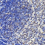 Immunohistochemistry - Anti-SP1 Antibody [ARC0128] (A308986) - Antibodies.com