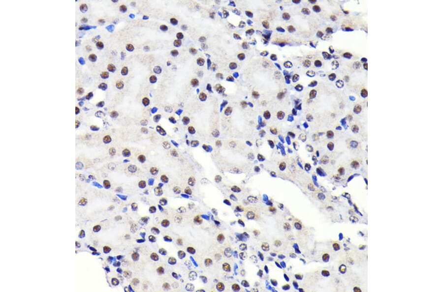 Immunohistochemistry - Anti-SP1 Antibody [ARC0128] (A308986) - Antibodies.com