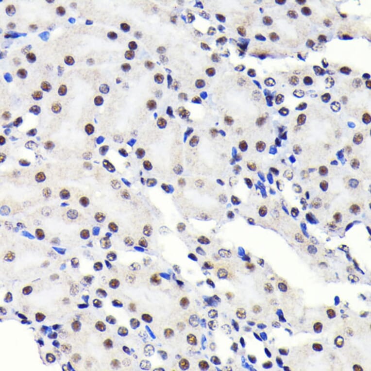Immunohistochemistry - Anti-SP1 Antibody [ARC0128] (A308986) - Antibodies.com