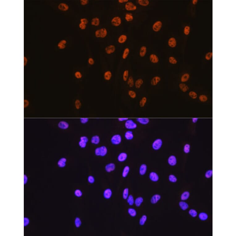 Immunofluorescence - Anti-SP1 Antibody [ARC0128] (A308986) - Antibodies.com