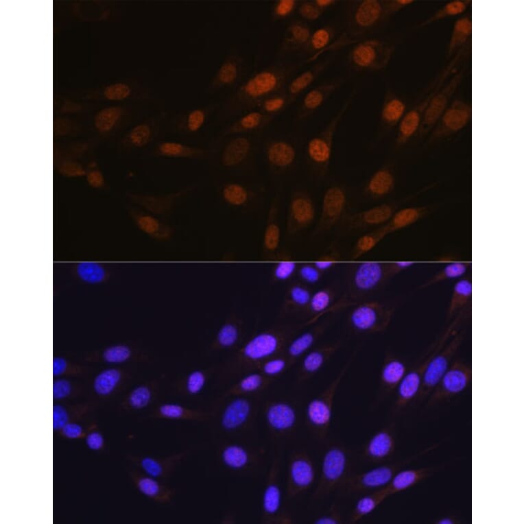 Immunofluorescence - Anti-SP1 Antibody [ARC0128] (A308986) - Antibodies.com