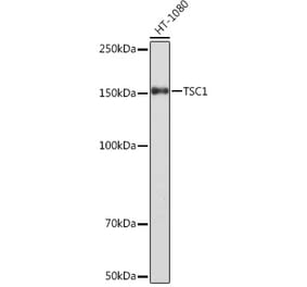Western Blot - Anti-Hamartin Antibody [ARC1236] (A308987) - Antibodies.com