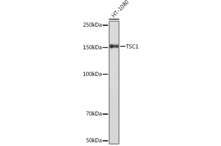 Western Blot - Anti-Hamartin Antibody [ARC1236] (A308987) - Antibodies.com