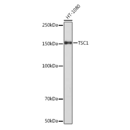 Western Blot - Anti-Hamartin Antibody [ARC1236] (A308987) - Antibodies.com