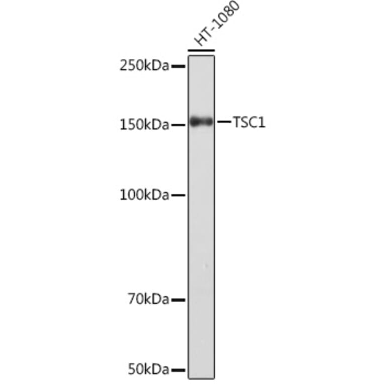 Western Blot - Anti-Hamartin Antibody [ARC1236] (A308987) - Antibodies.com