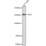 Western Blot - Anti-Hamartin Antibody [ARC1236] (A308987) - Antibodies.com