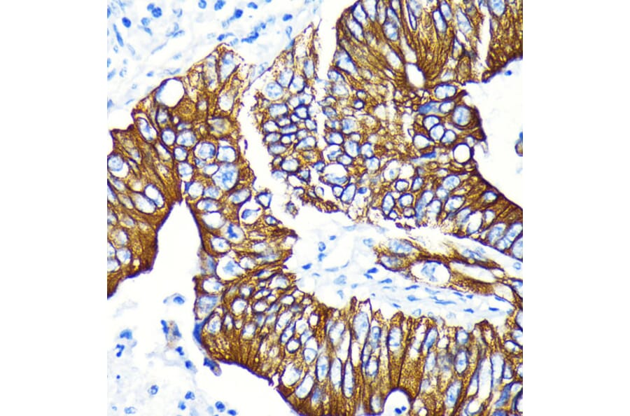 Immunohistochemistry - Anti-GSK3 beta (phospho Ser9) Antibody [ARC0069] (A308989) - Antibodies.com