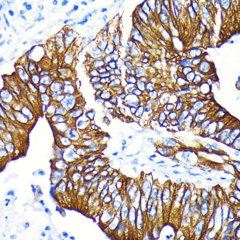 Immunohistochemistry - Anti-GSK3 beta (phospho Ser9) Antibody [ARC0069] (A308989) - Antibodies.com