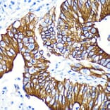 Immunohistochemistry - Anti-GSK3 beta (phospho Ser9) Antibody [ARC0069] (A308989) - Antibodies.com