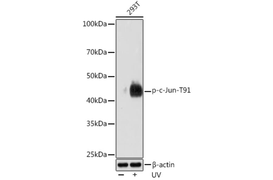 Western Blot - Anti-c-Jun (phospho Thr91) Antibody [ARC1548] (A308990) - Antibodies.com