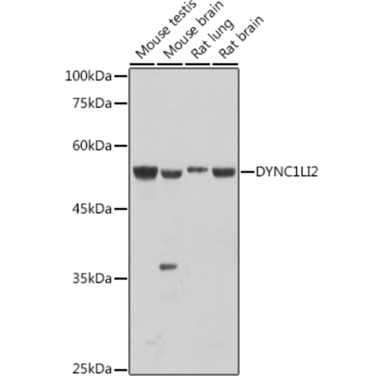 Western Blot - Anti-DYNC1LI2/LIC2 Antibody (A308992) - Antibodies.com