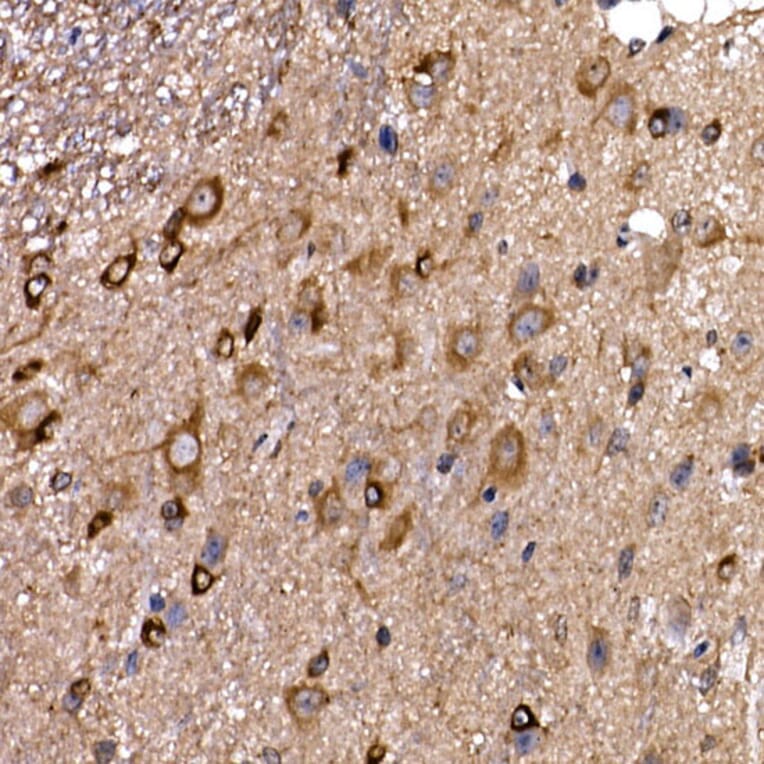 Immunohistochemistry - Anti-DYNC1LI2/LIC2 Antibody (A308992) - Antibodies.com