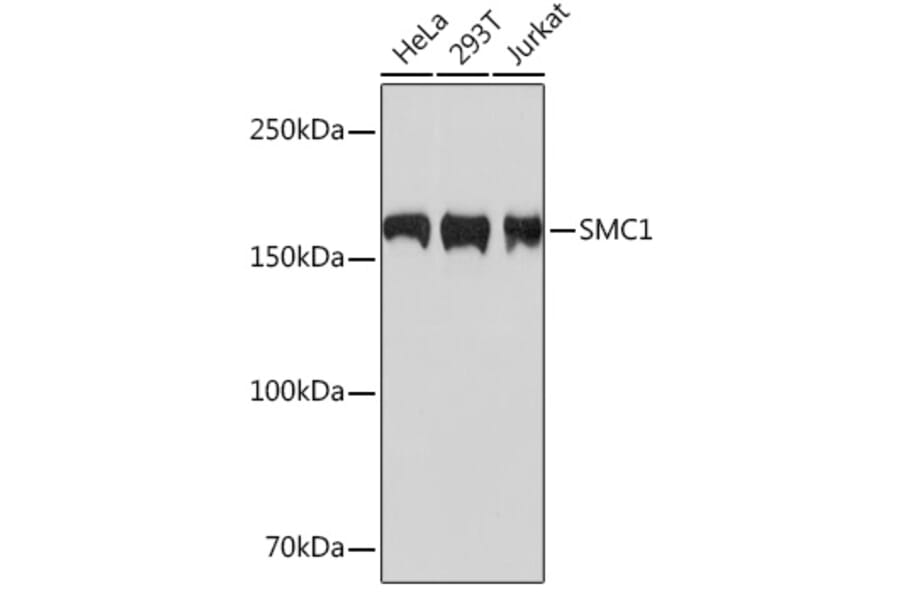 Western Blot - Anti-SMC1A Antibody [ARC1095] (A308993) - Antibodies.com