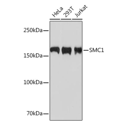 Western Blot - Anti-SMC1A Antibody [ARC1095] (A308993) - Antibodies.com