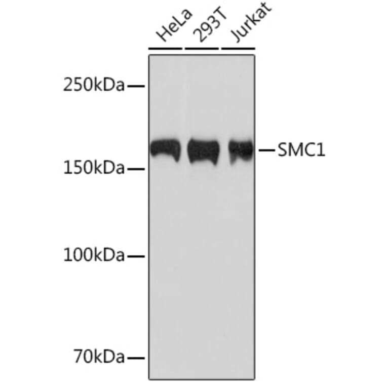 Western Blot - Anti-SMC1A Antibody [ARC1095] (A308993) - Antibodies.com