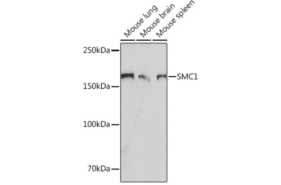 Western Blot - Anti-SMC1A Antibody [ARC1095] (A308993) - Antibodies.com