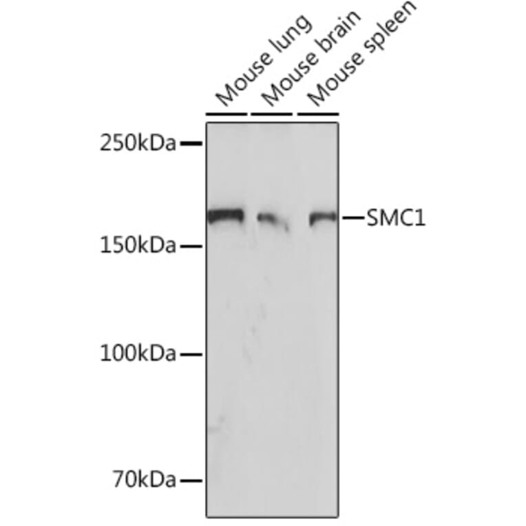 Western Blot - Anti-SMC1A Antibody [ARC1095] (A308993) - Antibodies.com