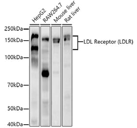 Western Blot - Anti-LDL Receptor Antibody [ARC51372] (A308994) - Antibodies.com