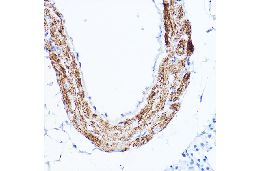 Immunohistochemistry - Anti-LDL Receptor Antibody (A308995) - Antibodies.com