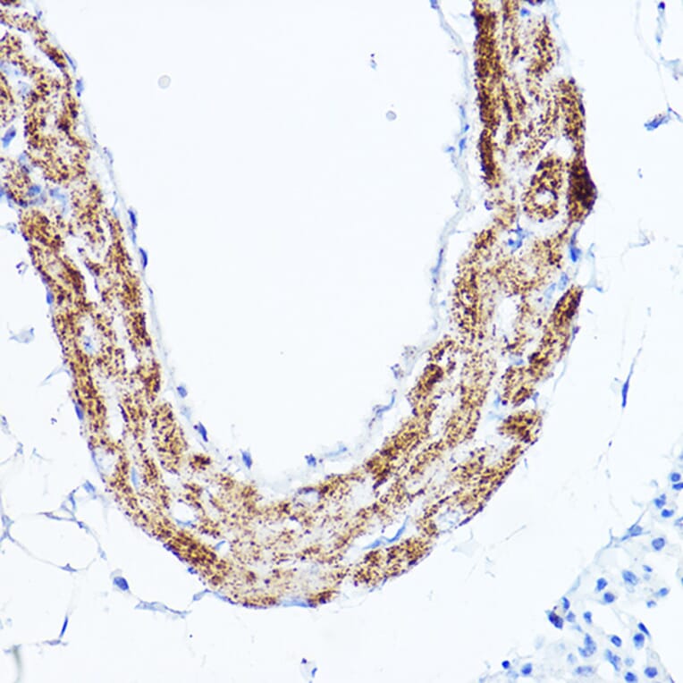 Immunohistochemistry - Anti-LDL Receptor Antibody (A308995) - Antibodies.com