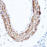 Immunohistochemistry - Anti-LDL Receptor Antibody (A308995) - Antibodies.com