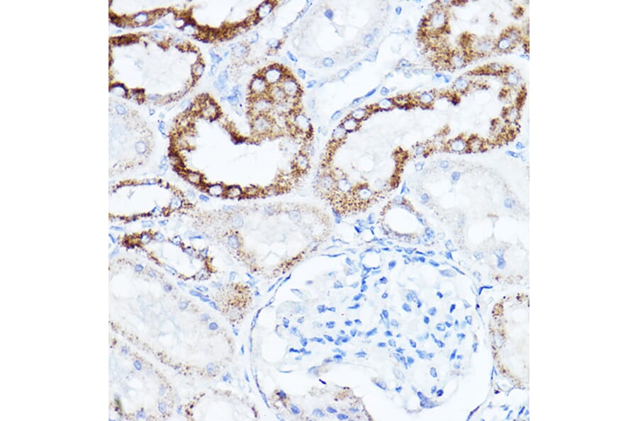 Immunohistochemistry - Anti-LDL Receptor Antibody (A308995) - Antibodies.com