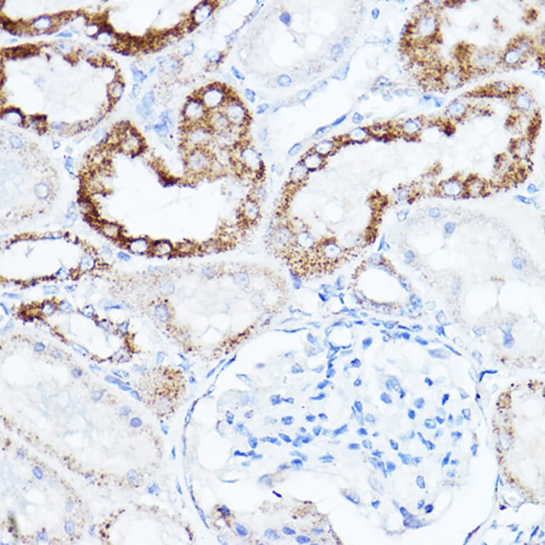 Immunohistochemistry - Anti-LDL Receptor Antibody (A308995) - Antibodies.com