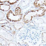 Immunohistochemistry - Anti-LDL Receptor Antibody (A308995) - Antibodies.com