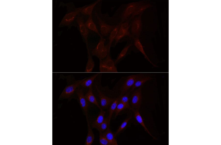 Immunofluorescence - Anti-LDL Receptor Antibody (A308995) - Antibodies.com